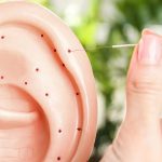 uriculothérapie-et-acupuncture-de-l-oreille